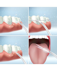 Portable Rechargeable Oral Irrigator Denter InnovaGoods